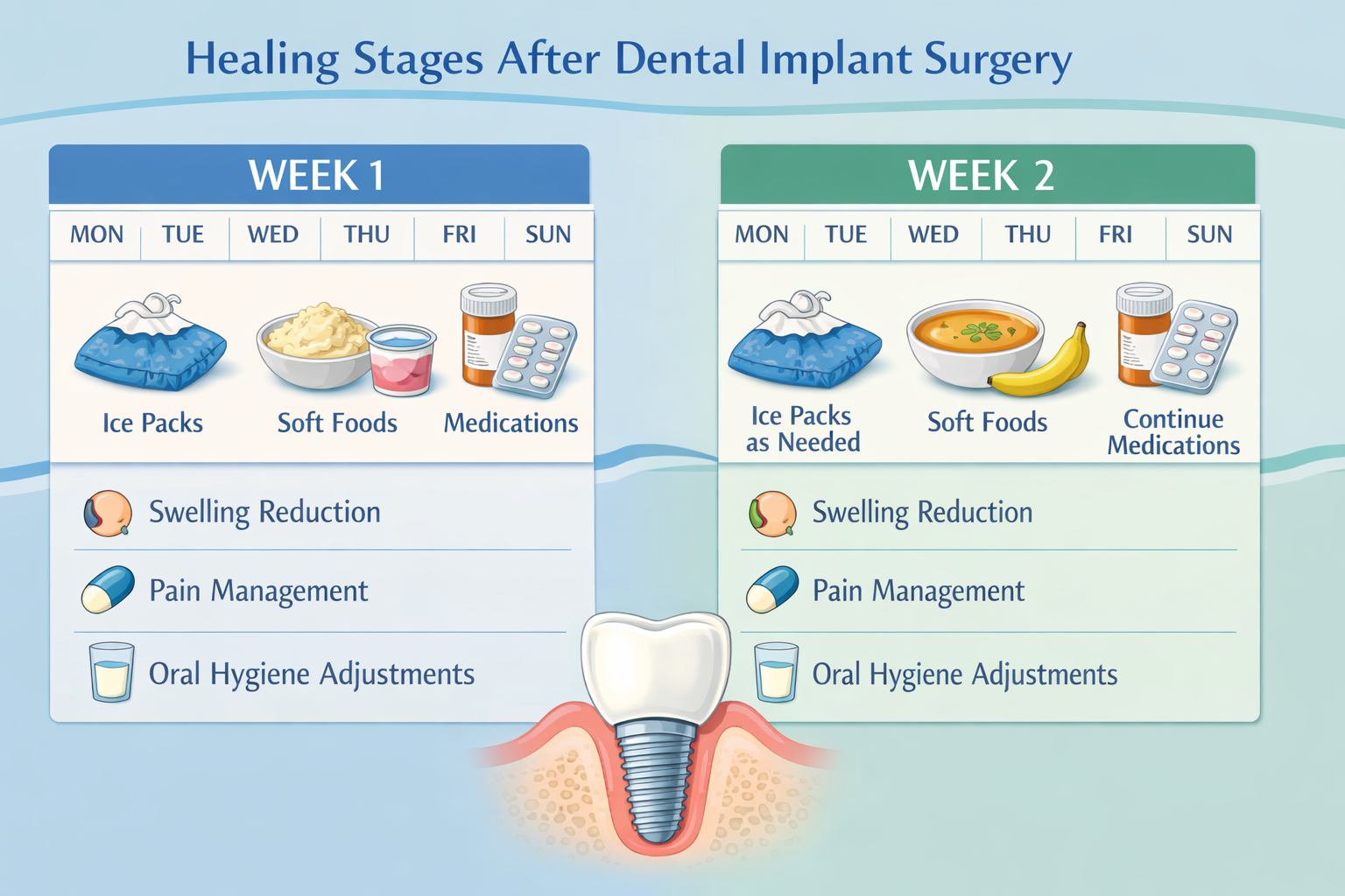 Initial Healing: Weeks 1-2 After Dental Implant Surgery