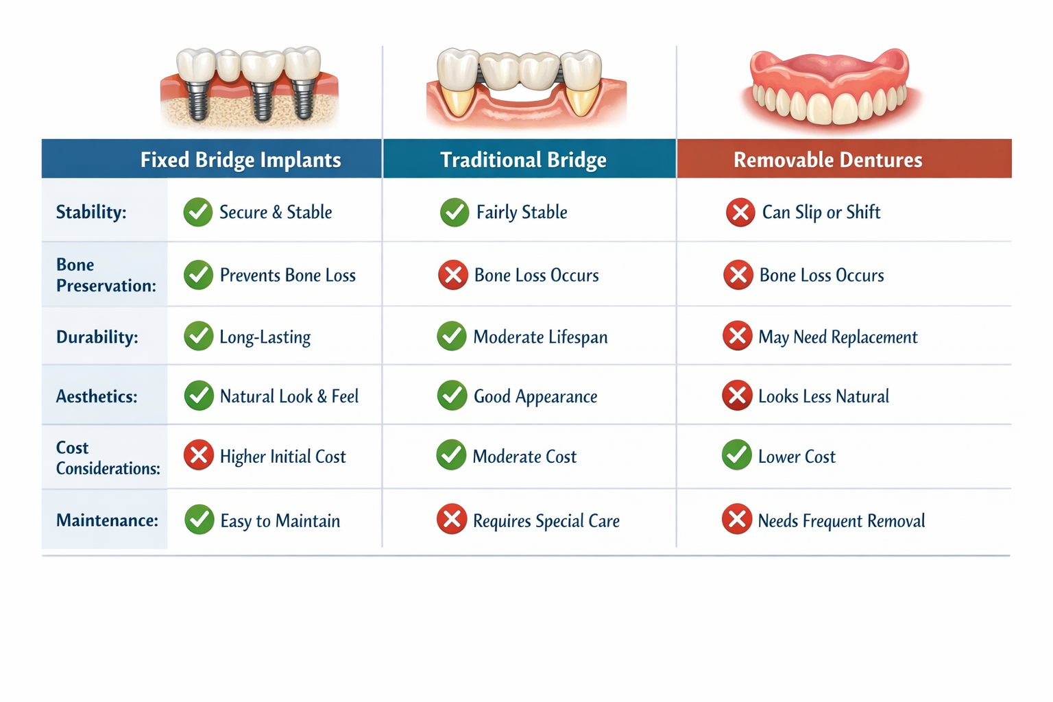 Fixed Bridge Dental Implants: Your Comprehensive 2026 Guide to a Lasting Smile in Dallas, TX