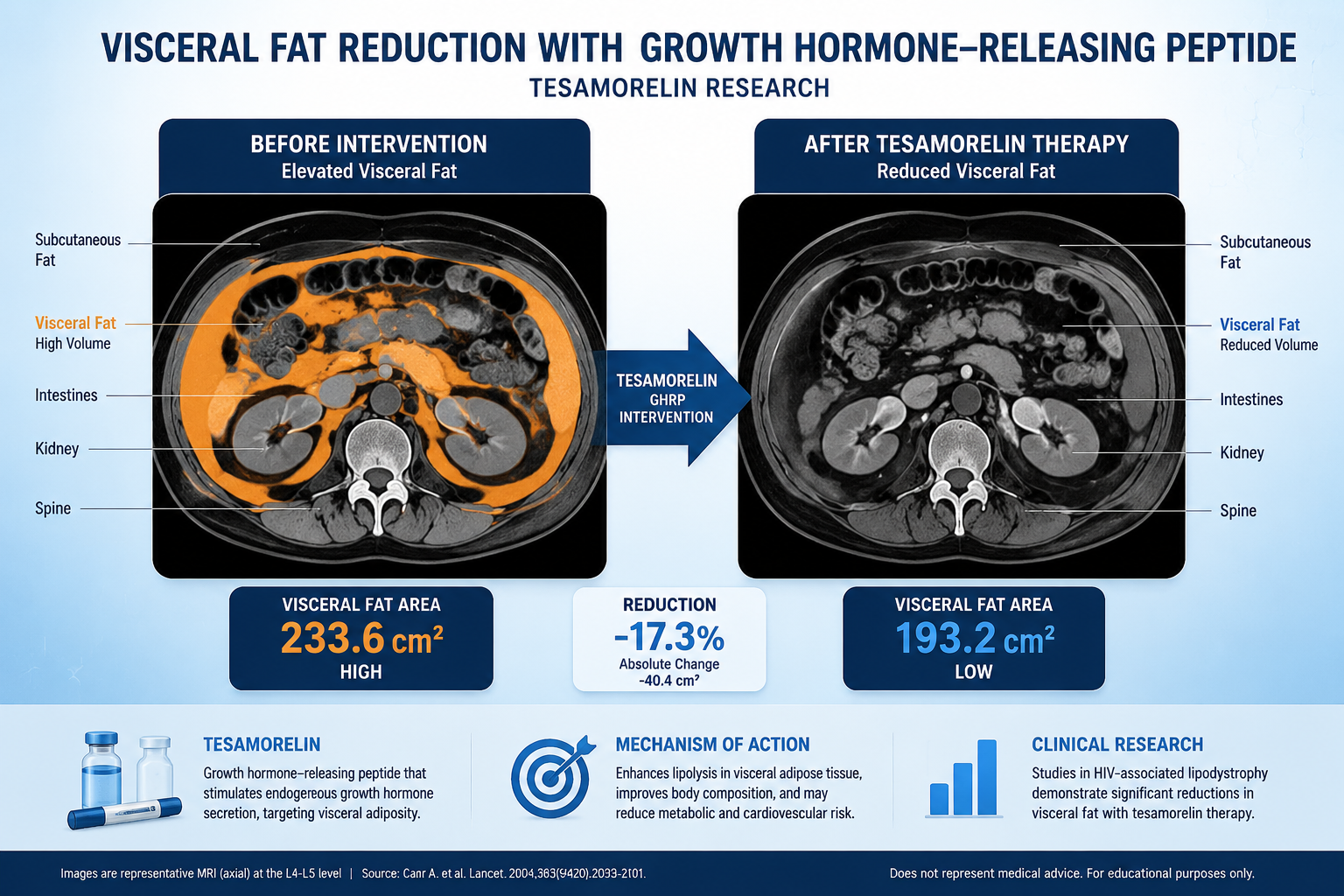 Detailed () informational graphic showing a cross-sectional MRI-style illustration of the human abdomen comparing visceral