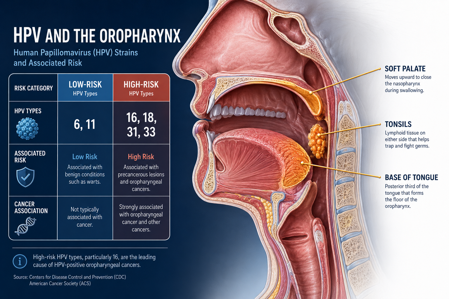 () detailed medical illustration of the human oropharynx in cross-section, showing tonsils, base of tongue, and soft palate
