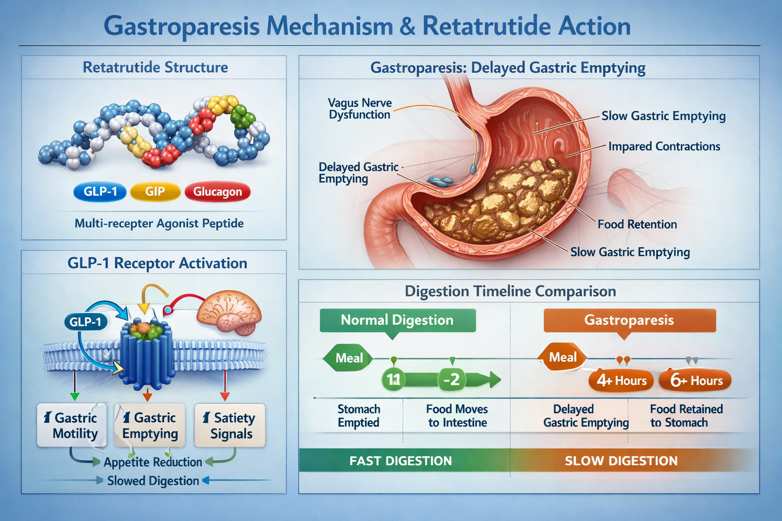 Retatrutide Gastroparesis Risk