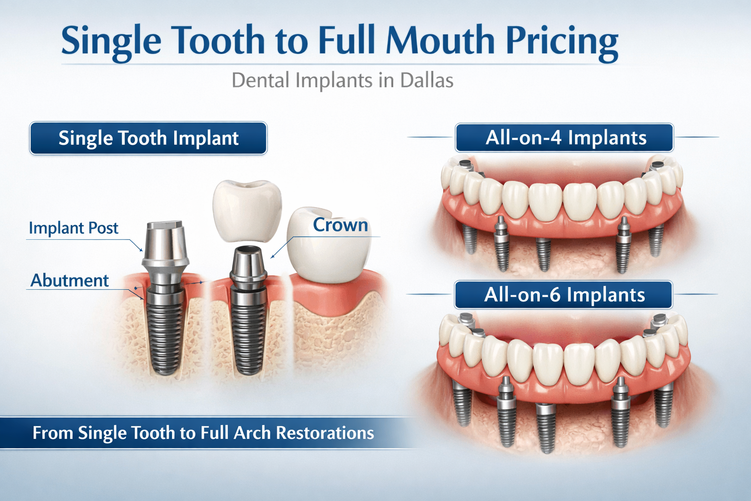A compelling landscape format (1536x1024) image showcasing a diverse range of dental implant solutions, from a single missing tooth to full 