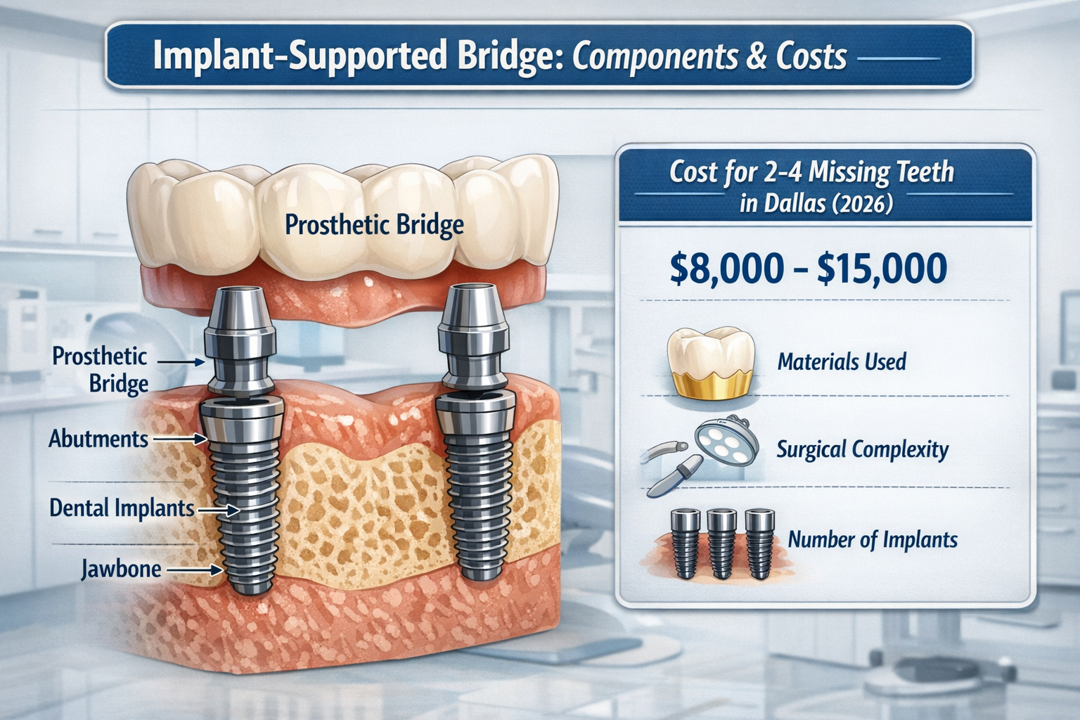 A detailed infographic in landscape format (1536x1024) illustrating the components of an implant-supported bridge, including dental implants