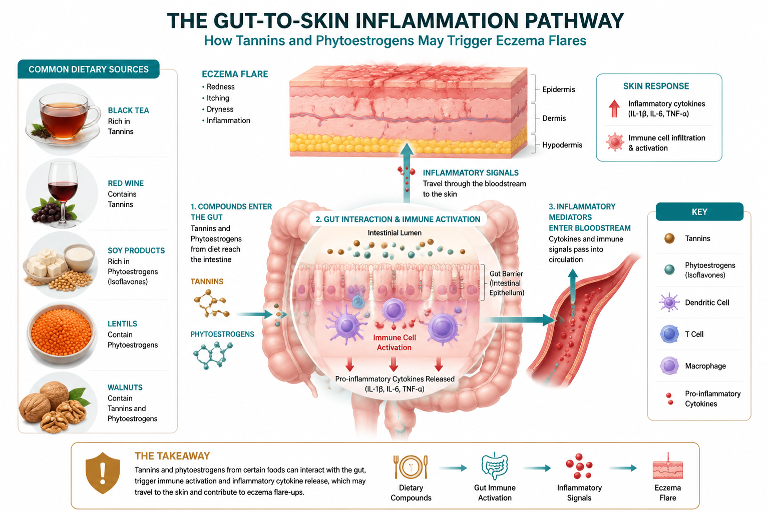 Detailed () scientific infographic illustration showing the gut-to-skin inflammation pathway. Central diagram depicts human
