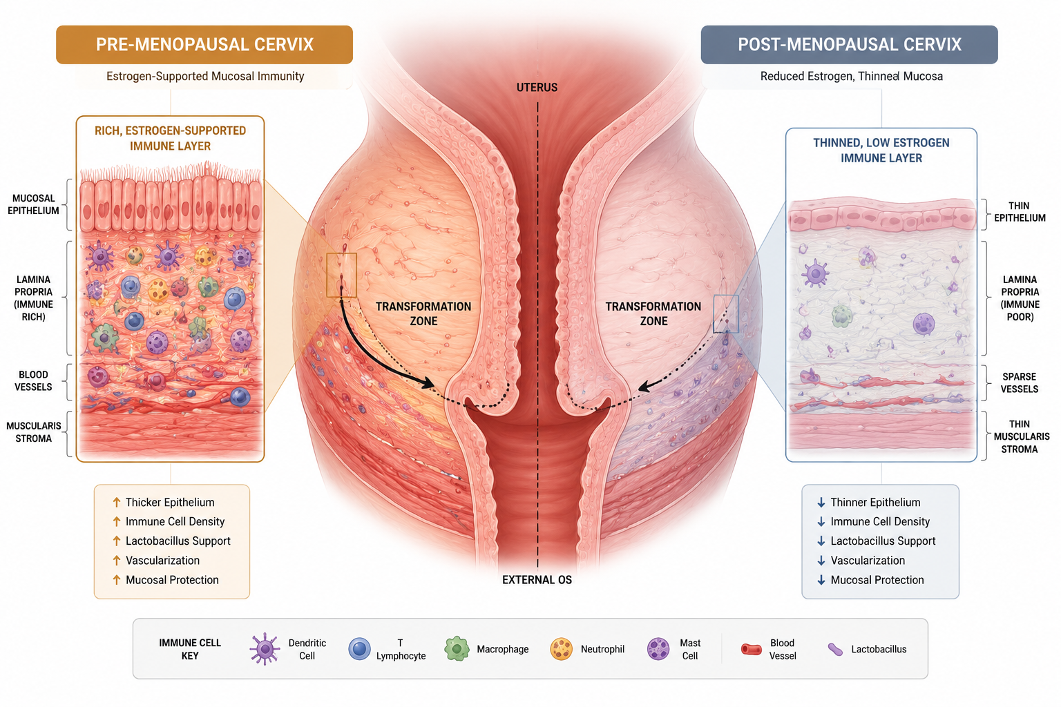 Detailed () anatomical cross-section illustration of the cervix showing mucosal immune layer changes before and after