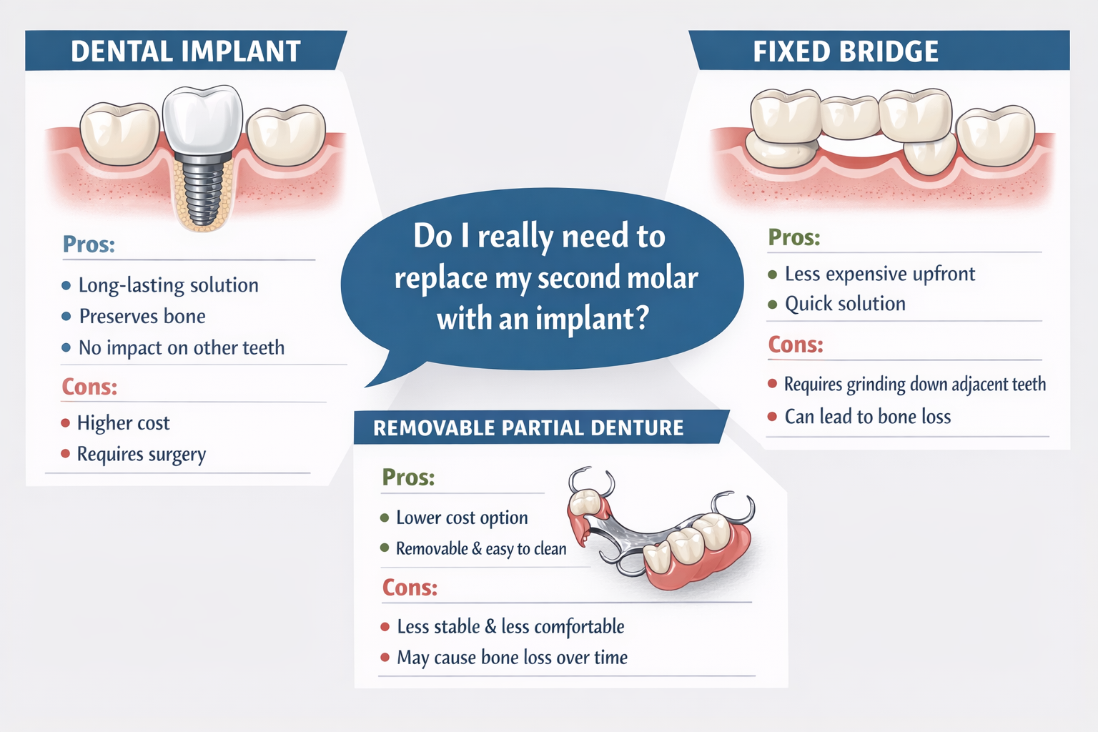 Do I really need to replace my second molar with an implant?