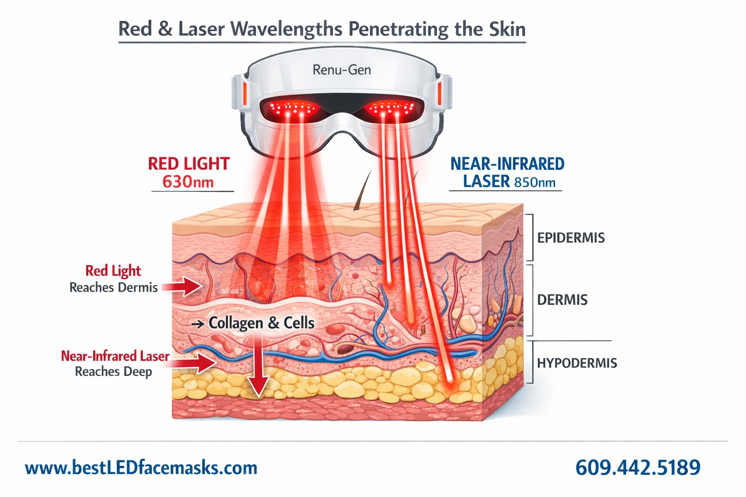 () infographic-style image illustrating how red light and laser wavelengths penetrate layers of the skin epidermis.