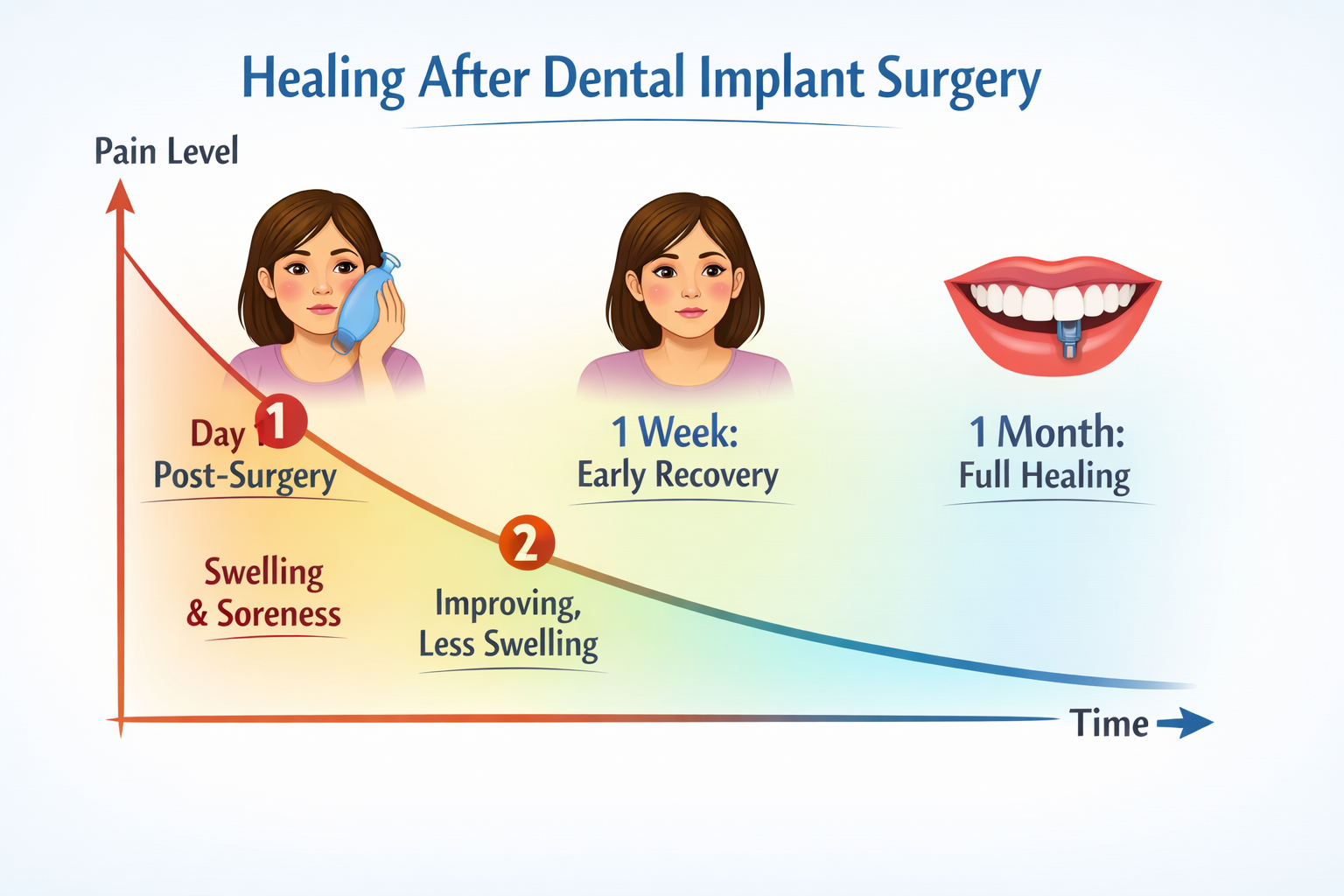 Comprehensive Guide to Pain Relief After Dental Implants