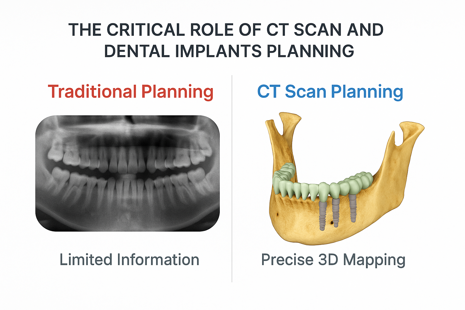 CT Scan and Dental Implants