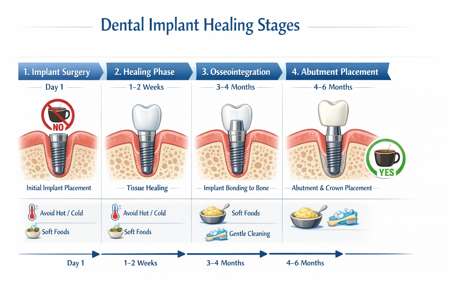 Coffee After Dental Implant Surgery: Your Comprehensive Guide to Safe Sips and Speedy Healing