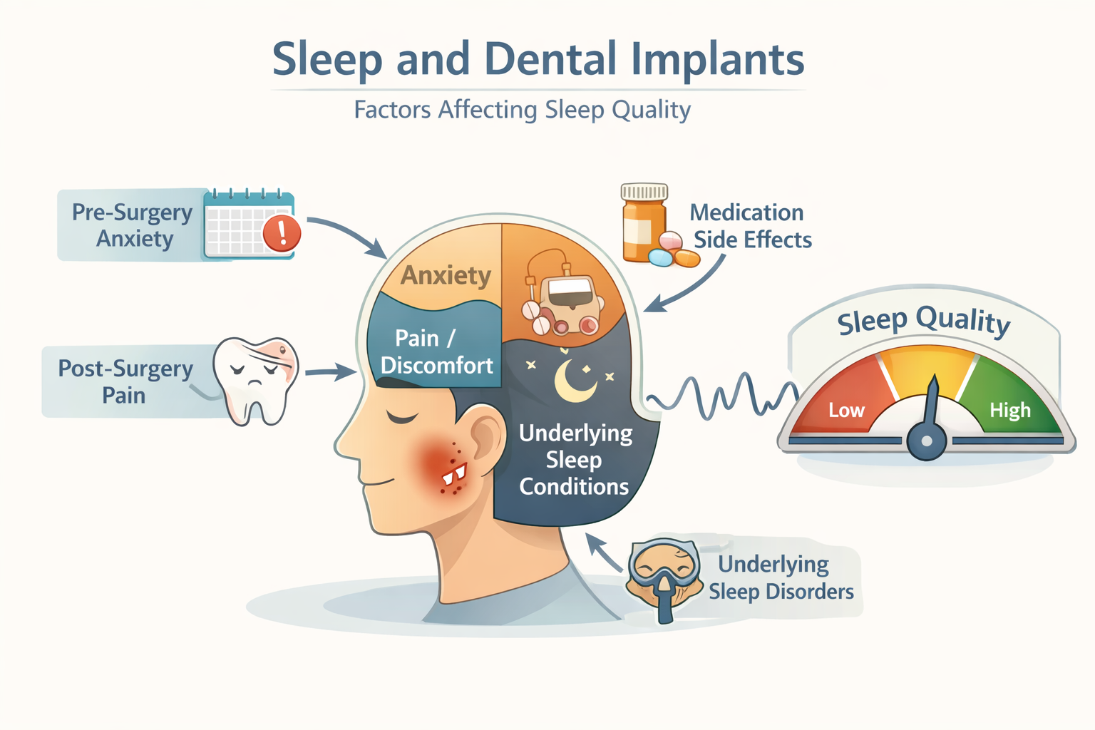 Can Dental Implants Affect Sleep? Dallas Guide 2026