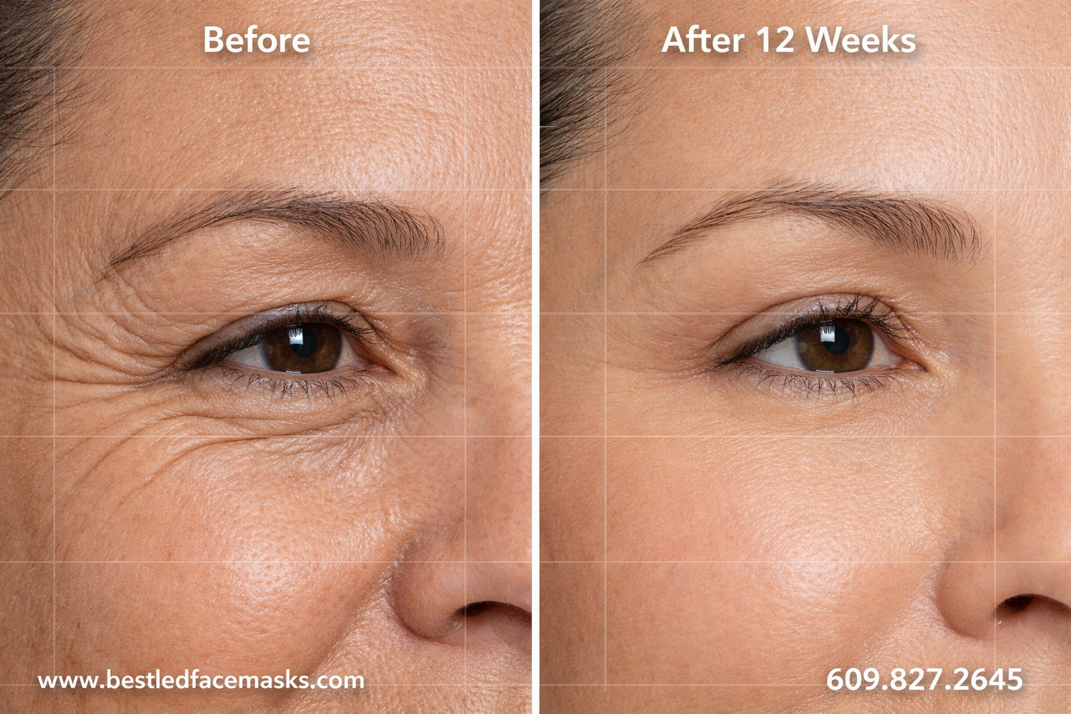 () split-screen before-and-after style image showing two side-by-side close-up views of facial skin around the eye area: