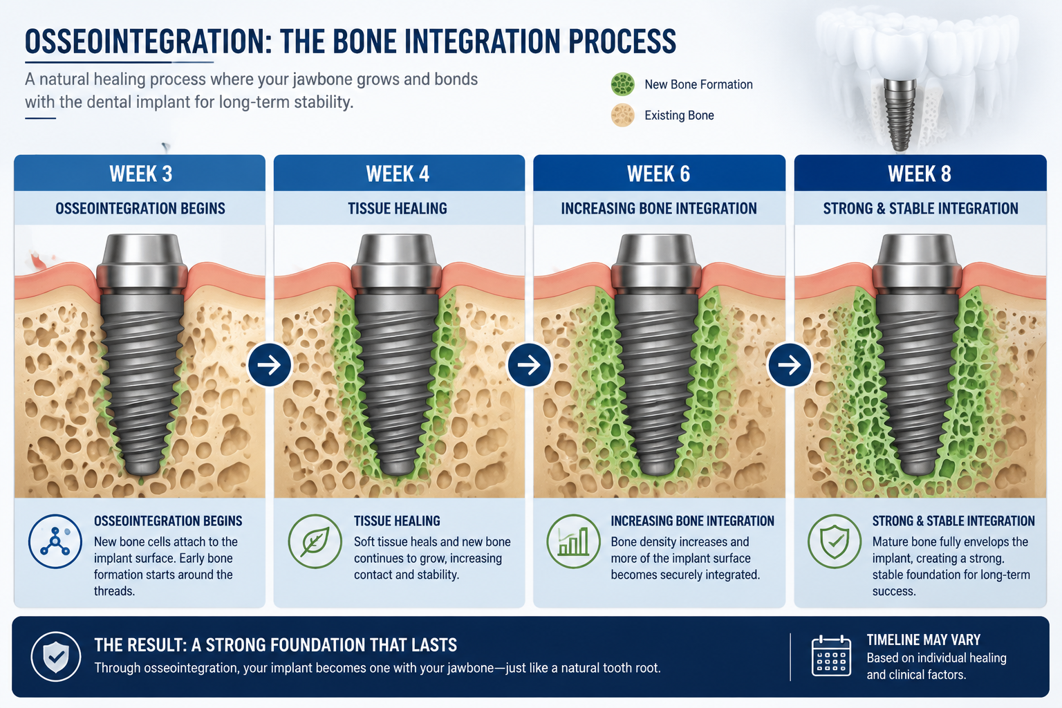 () infographic or diagram visually representing the bone integration process (osseointegration) over several weeks. Use a