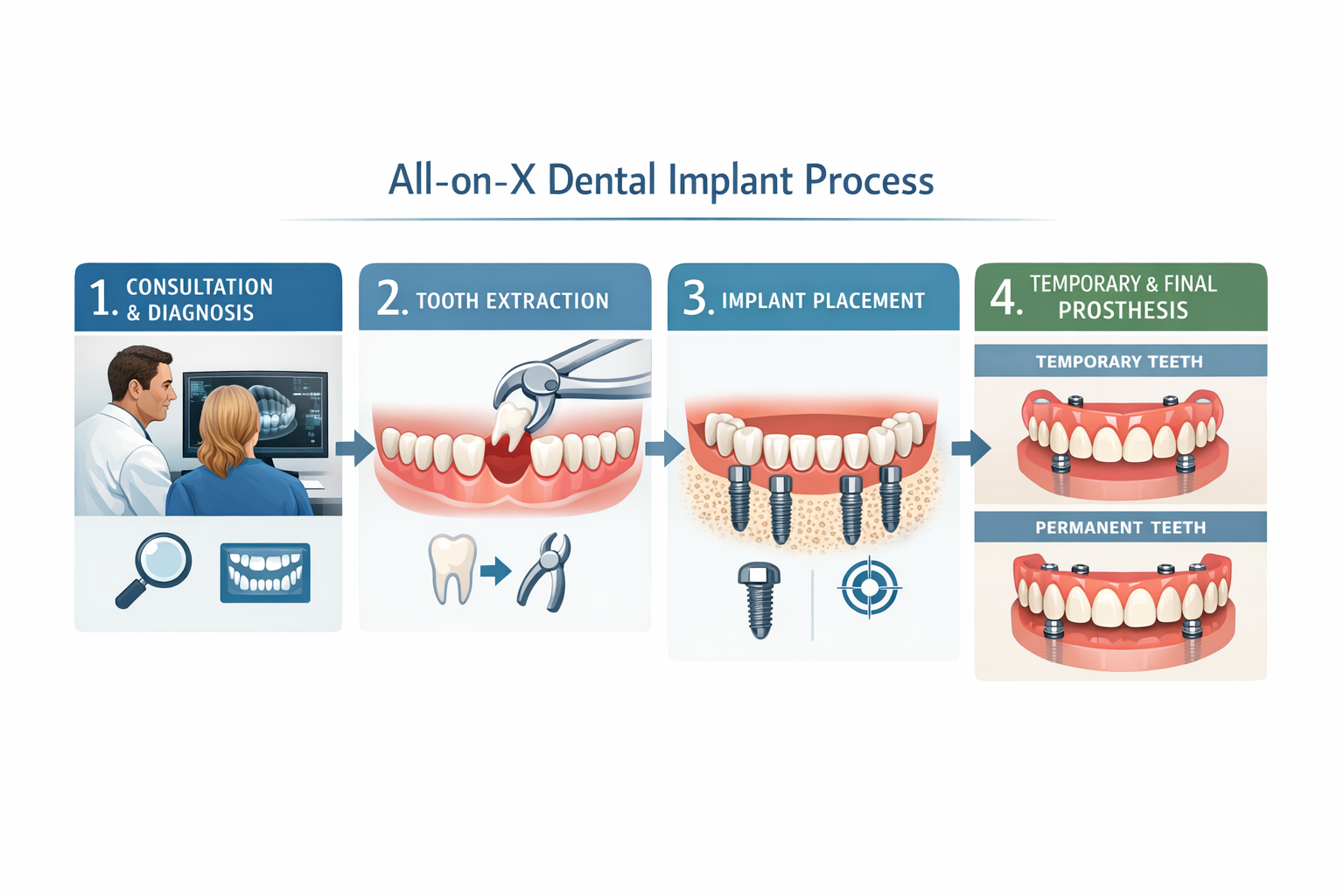 All-on-X Dental Implants Dallas