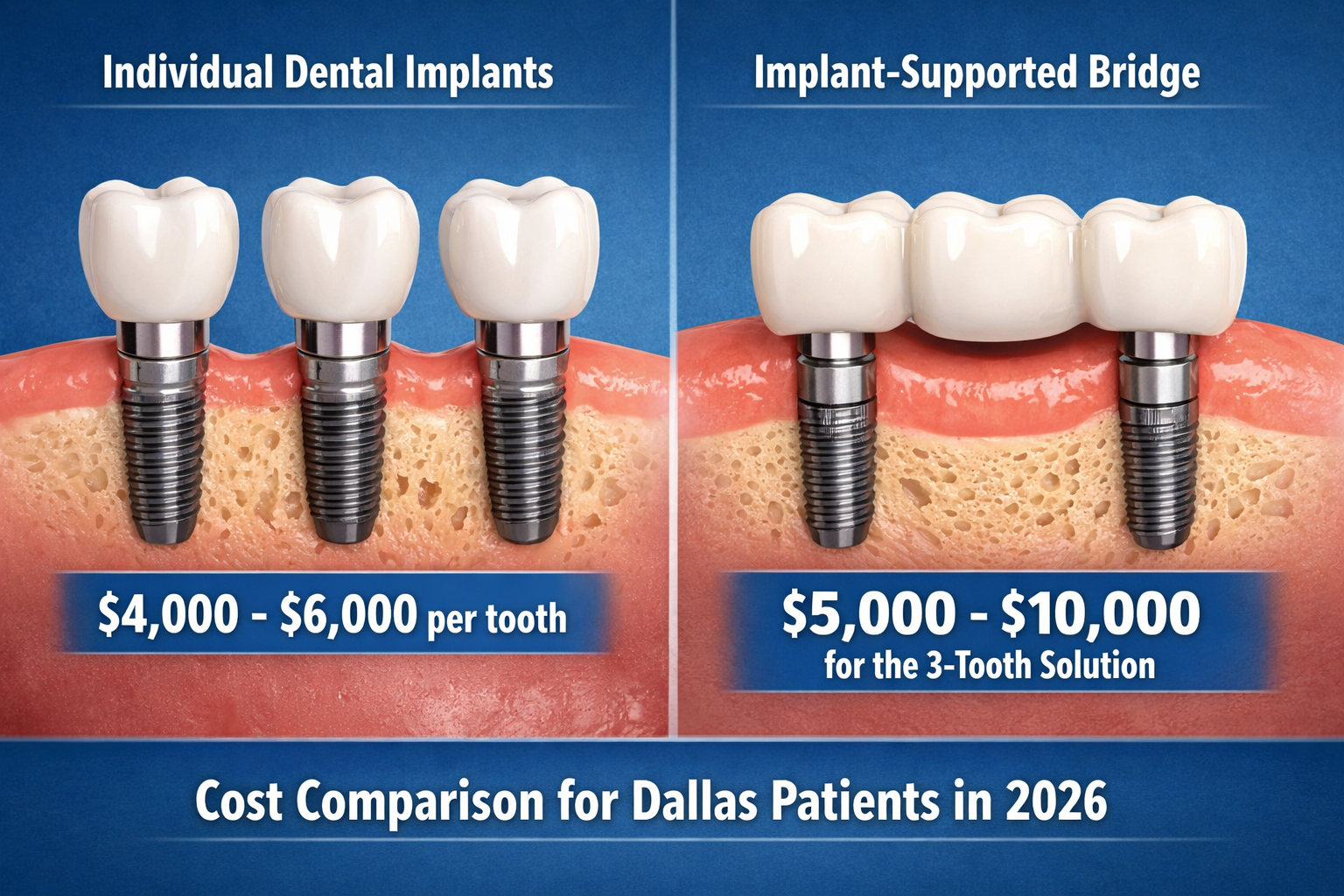 Landscape format (1536x1024) image featuring a split comparison visual. On one side, three individual dental implants are shown, each with i