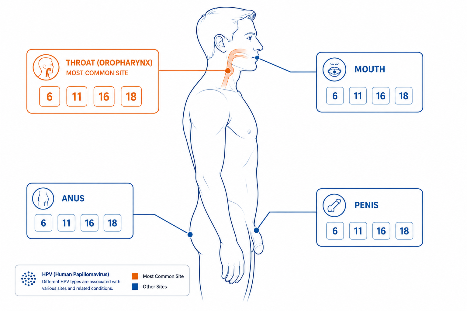 () clean medical diagram showing a male body outline in profile with four anatomical sites highlighted: throat/oropharynx,