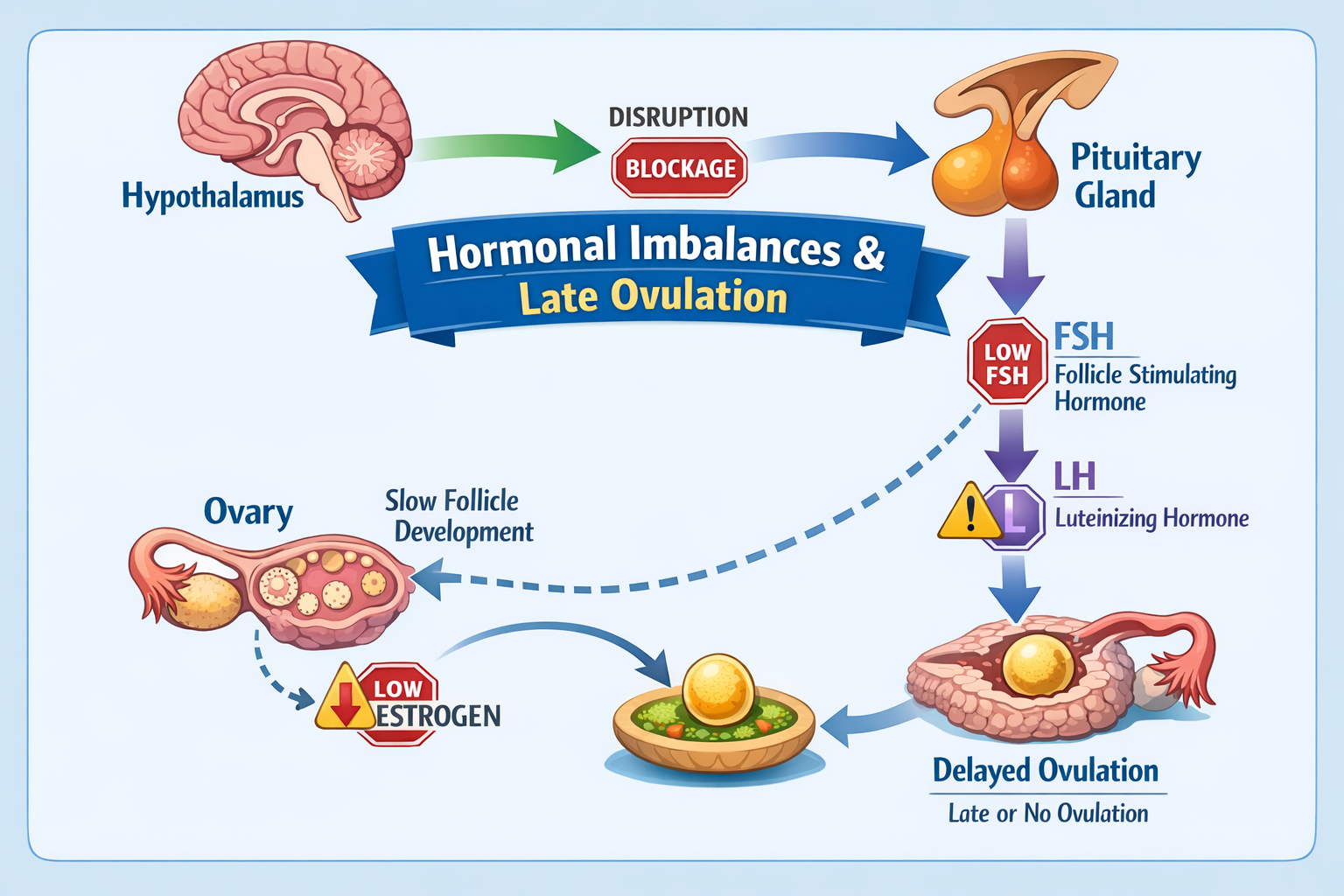 A detailed infographic style image illustrating the hormonal axis (hypothalamus-pituitary-ovarian axis) and how disruptions in FSH, LH, and 