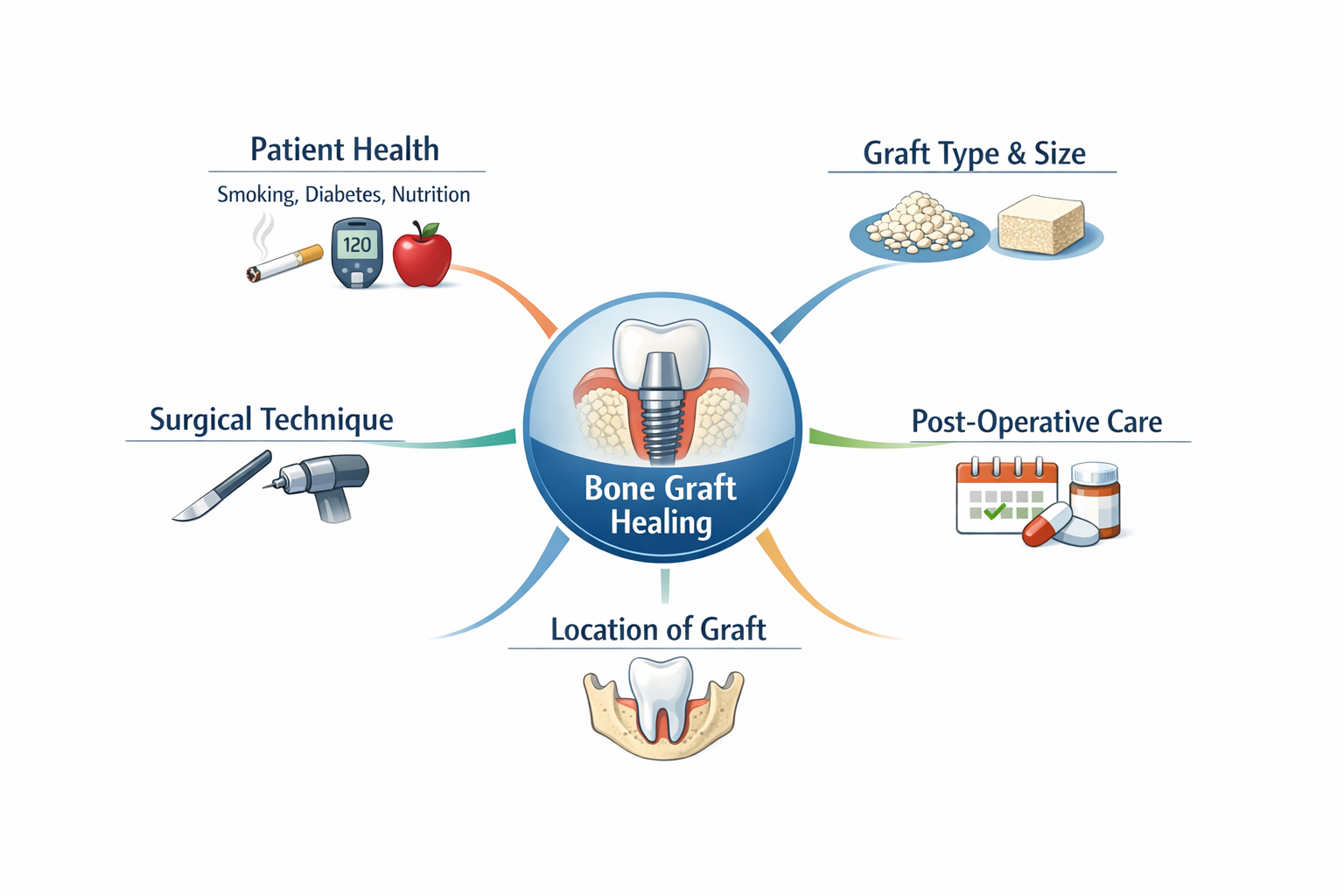 How Long Does a Bone Graft Take to Heal Before I Can Get My Dental Implant?