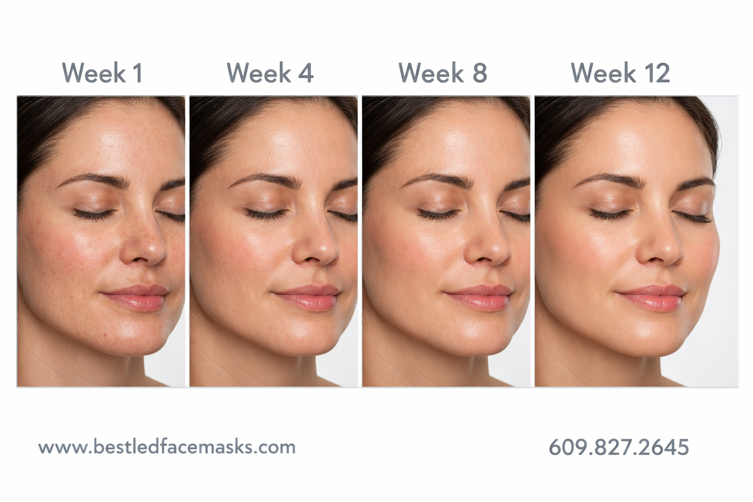 () before-and-after style visual showing a timeline of skin improvement over 12 weeks of red light therapy mask use. Four