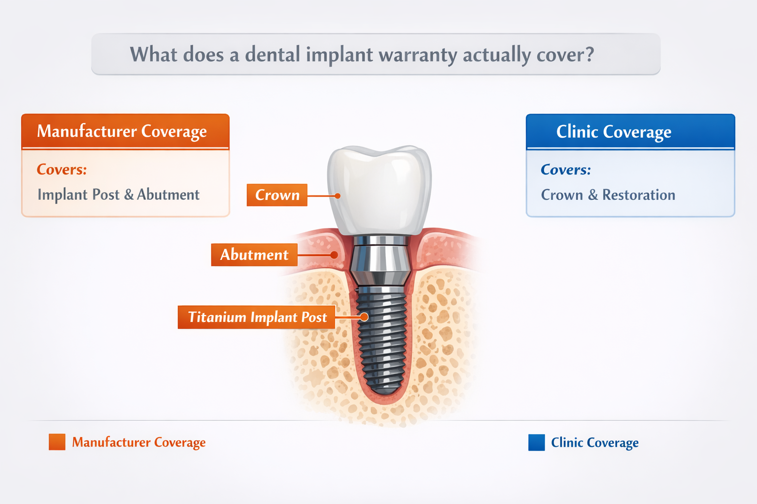 What does a dental implant warranty actually cover