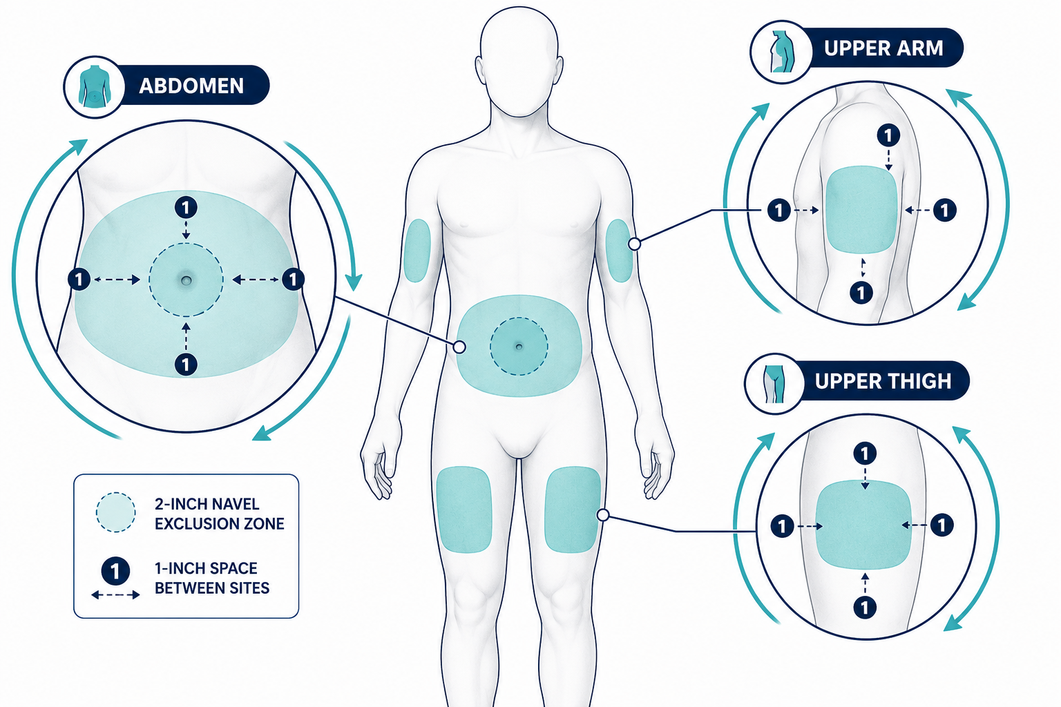 Where to inject tirzepatide on your body