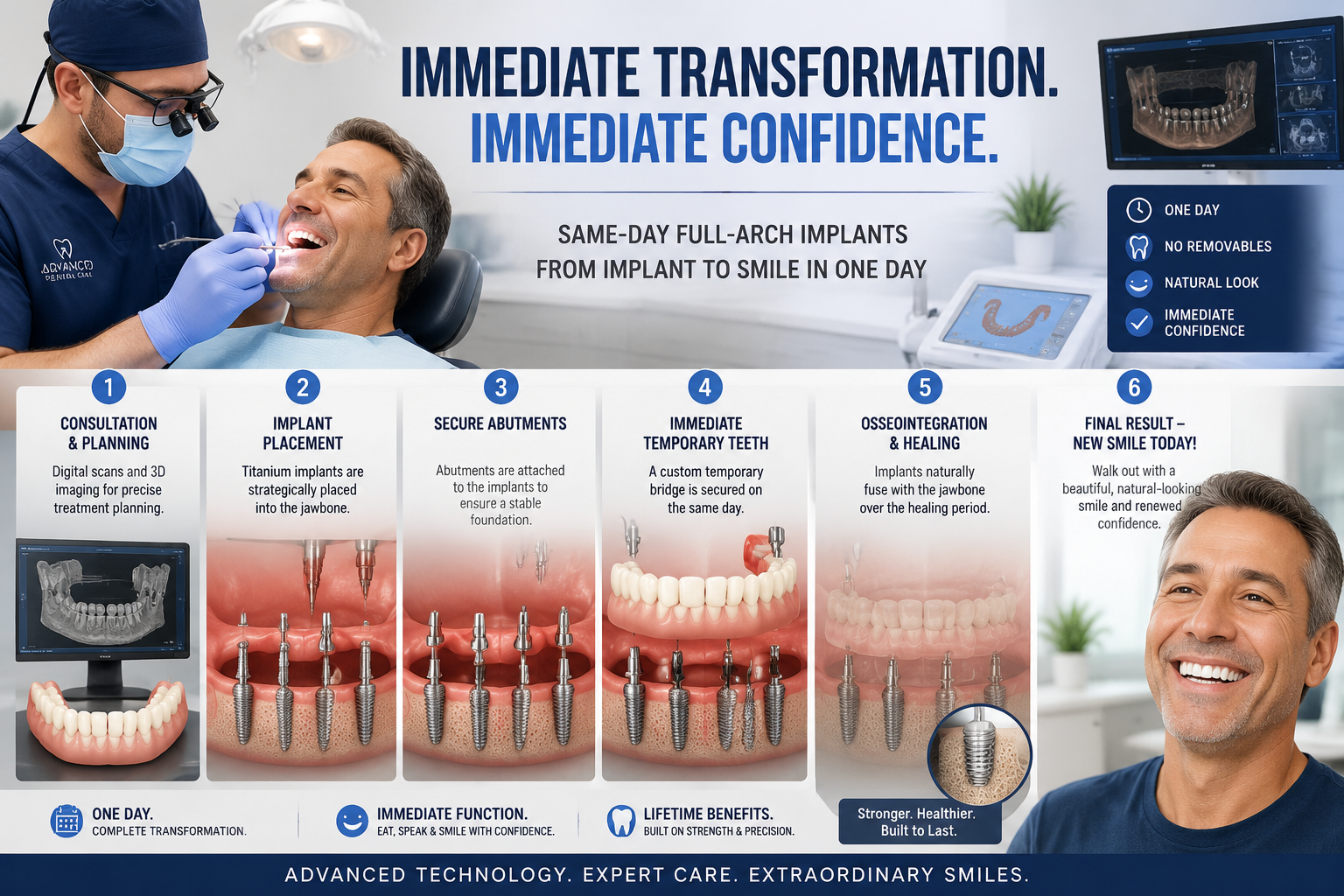 A () illustration showcasing the entire same-day full procedure for immediate load dental implants, from initial implant