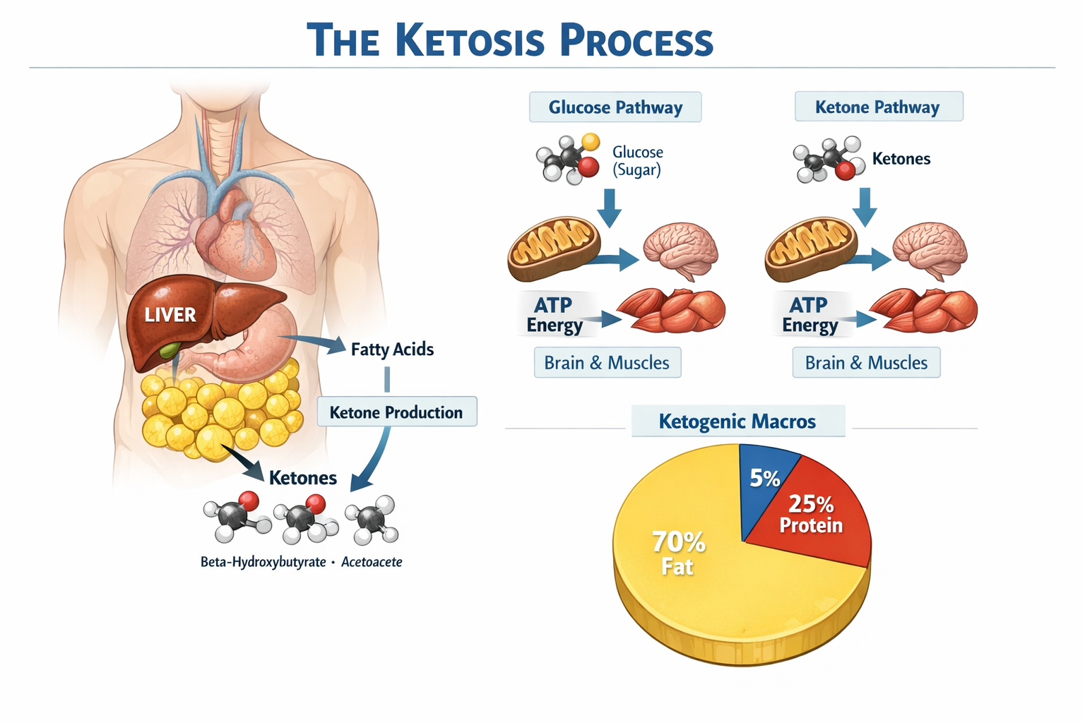 Detailed anatomical-style infographic showing the ketosis process: liver converting fat to ketones, glucose vs ketone energy