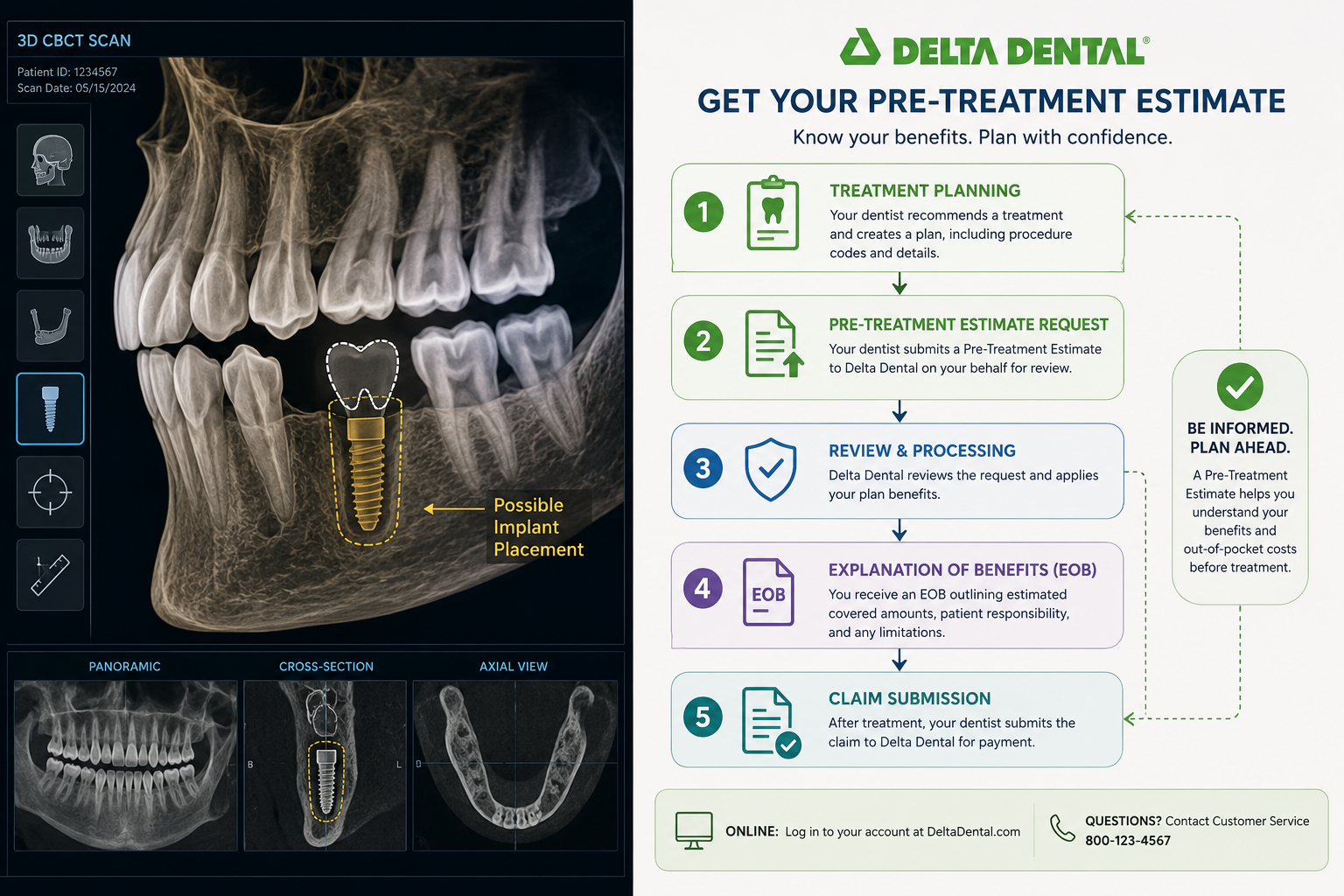 Maximizing Your Delta Dental Benefits for Implants: Pre-Treatment Estimates and Downgrade Clauses