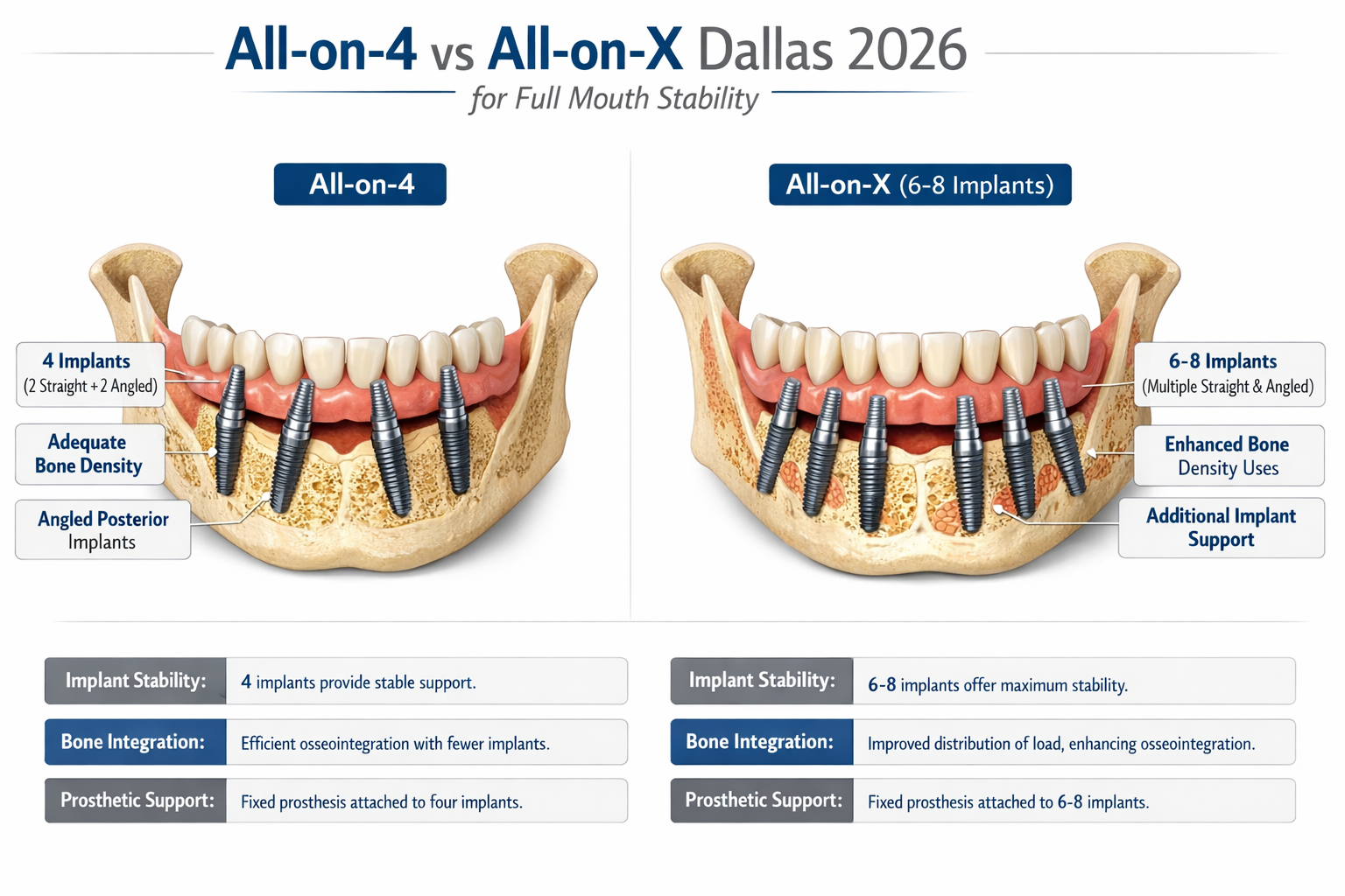 A detailed infographic comparing All-on-4 and All-on-X dental implant systems, showing side-by-side technical illustrations of jawbones with