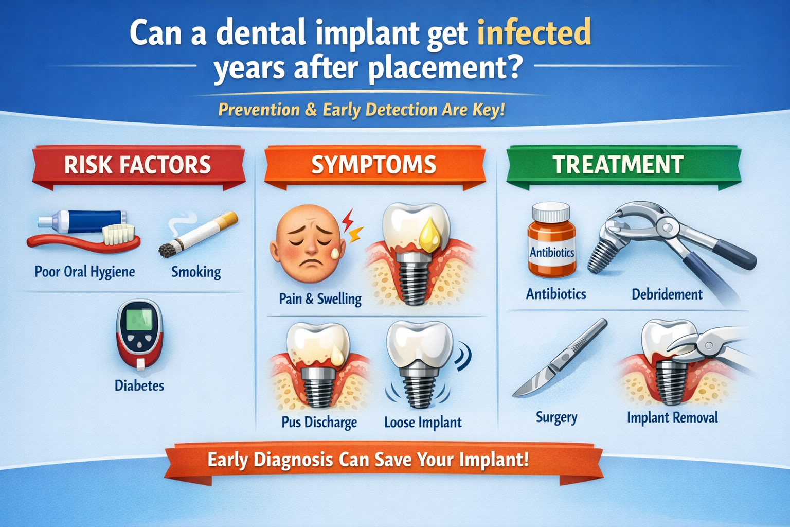 Can a Dental Implant Get Infected Years After Placement? A Comprehensive Guide for 2026